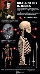 Jul 16, 2021 · king richard iii visitor centre 4a st martins leicester le1 5db tel: A Study Of King Richard Iii S Bones Uncovered 11 Injuries Inflicted Near The Time Of Death By Common Late Medieval Weapo Richard Iii King Richard Tudor History
