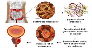 Prostate Cancer Overview Symptoms Treatment Prevention