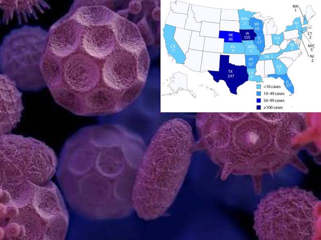 Cyclospora Outbreak in US: Diarrhea-Causing Parasite Infects 145 Across 17 States; Michigan Cases Continue to Rise — Check Symptoms, Meaning and How to Protect Yourself
