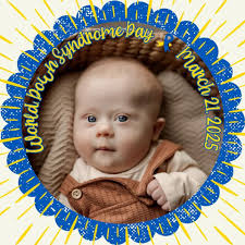 It's the kits!! Telling you- don't ever wear those damn yellow kits  again!!!!