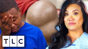 Dr Sandra Lee Removes Larry The Lump From Man's Chest