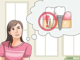 Take a deep breath and try these tips if you find that money's a bit tight. How To Afford Dental Implants 15 Steps With Pictures Wikihow