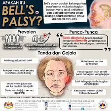 It's believed to be the result of swelling and inflammation of the nerve that controls the muscles on one side of your face. Klinik Pergigian Nor Kenapa Muka Tiba Tiba Senget Sebelah Tapi Bukan Strok Hmm Pelik Ada Kemungkinan Anda Mengalami Bell S Palsy Jom Lihat Apa Itu Bell S Palsy Kkm Pergigian Facebook