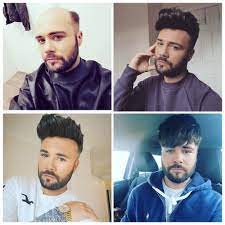 With Beautiful Hair Like This Everyday Is Good Hair Day Hair System Men Hair Problem Mens Hairstyles