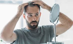 Learn more about other possible causes of thinning. Traitements Anti Chute De Cheveux Chez L Homme Revivre Labs