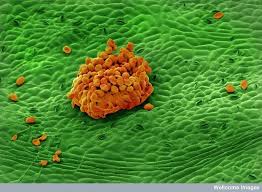 Hence, good moisture control is essential to keeping them at bay. Phragmidium Tuberculatum A Cause Of Rose Rust The Little Black Spots Are The Pores In The Leaf Called Stomata If Thi Fungi Rose Leaves Microscopic Images