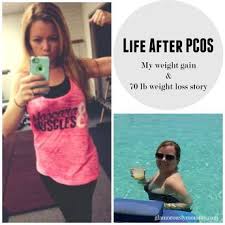 Pin On Pcos