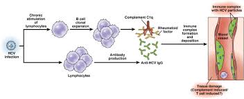 There are seven major genotypes of hcv, which are known as genotypes one to seven. Manifestations Of Chronic Hepatitis C Virus Infection Beyond The Liver Clinical Gastroenterology And Hepatology