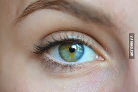 Maybe that is what gives her such a penetrating gaze. Sectoral Heterochromia 9gag