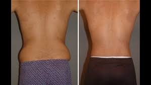 Hack it with a body shaper. What Are The Best Exercises To Get A Good V Shaped Body And Back For Men Quora