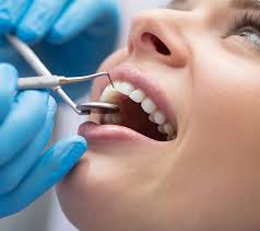 In addition, highly aesthetic dental prostheses can be built over these implants, . Dental Bonding Chino Ca Smile Artistry Chino Valley Fix Your Chipped Or Discolored Tooth