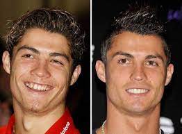 Cristiano ronaldo dos santos aveiro) родился 5 февраля 1985 года в фуншале (о. 404 Not Found Celebrity Teeth Ronaldo Celebrity Smiles