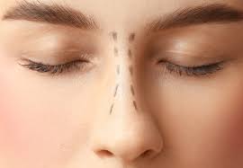Why Rhinoplasty Is Becoming Popular Among Millennials