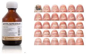 как сделать мазь от грибка ногтей из яйца и уксуса Degot Berezovyj Primenenie Ot Gribka Recepty Lecheniya Ot Fitoterapevta Halisat Sulejmanovoj Zdorove Fitoterapiya Travolechenie