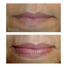 Lip Color And Volume That Lasts And Lasts Juvessentials Cosmetic Lip Tattooing In San Francisco 490 Lip Colors Lotion For Dry Skin Cosmetic Lip Tattoo