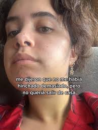 Mordida Desviada Antes Y Despues