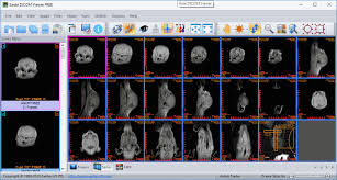 Opening dicom images from local drive, network shares and removable medias; 16 Best Free Dicom Viewer Software For Windows