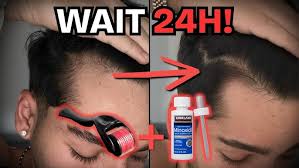 Image result for Minoxidil