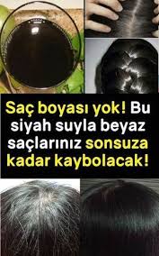 Bu Yontemle Kimyasallar Kullanmadan Sadece Bir Madde Kullanarak Sonsuza Kadar Beyaz Saclardan Kurtulun Beyaz Sac Sac Dogal Sac