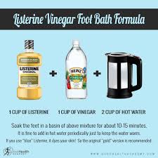 Promises that a listerine foot soak will leave dry, cracked feet rejuvenated and smooth have been making their way around pinterest. Why Choose Listerine As A Foot Soak How It Works Recipes