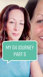My G4 journey, Part 6 #g4bygolpa #fixedbridgejourney #dentalimplants #...