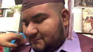 New Braunfels Teen Fighting for Life, Leg Amputated