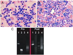 Some dogs are more prone to cancerous conditions leaving them without any possible recovery. Bone Marrow Cytologic And Molecular Complete Response In A Dog With Download Scientific Diagram