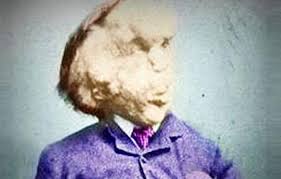 Maybe you would like to learn more about one of these? Top 10 Interesting Facts About The Elephant Man Listverse