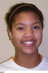 Summer Smiles Part II