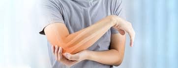 Find symptoms,causes and treatments of hand disease.for your health. Ulnar Collateral Ligament Ucl Injuries Of The Elbow Johns Hopkins Medicine
