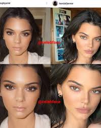 We did not find results for: What Do Ig Accounts Like Celebface Get Out Of Exposing Celebrity Surgery Dazed Beauty