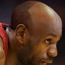 Your forehead looks like it's plotting the eventual takeover of the rest of your face. Lebrons Hairline Lebumhairline Twitter