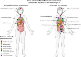 Image result for BRCA2