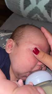 Does this look like a heat, rash, dry, rash, drawer rash she's had it for a  while and sometimes than other, has it