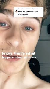 Gavin Grubbs Muscular Dystrophy