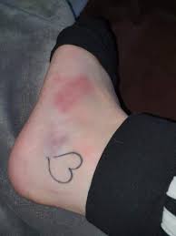 Zu hause hatte ich dann am freitag bis samstag mittag starke schmerzen und der fuß ist leicht angeschwollen. Fuss Umgeknickt Soll Ich Zum Arzt Gesundheit Und Medizin