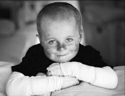 Mason is in constant pain from rare genetic condition