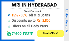 Ct Scan Cost In Yashoda Hospital Ct Scan Machine