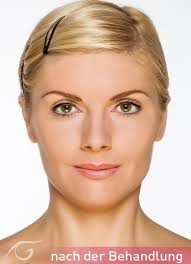 Natürlichkeit bewahren