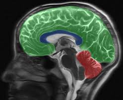 Vorgestern sind die bildeer in der neurologischen praxis angekommen. Mrt Des Kopfes