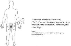 Cauda Equina Syndrome Spine Orthobullets