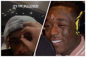Lil uzi vert diamond bleeding. Fans Go Crazy After Lil Uzi Vert Has 24m Pink Diamond Embedded Into Forehead Vibe Houston