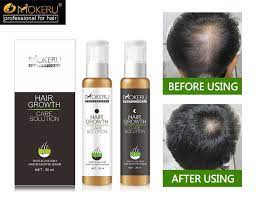 Rice water hair growth spray. Free Samples Mokeru Anti Hair Loss Treatment Hair Growth Lotion For New Hair Regrowth 30ml 2 Chinese Herbal Medicine Serum Buy Hair Growth Lotion Hair Loss Treatment For Hair Regrowth Anti Hair Loss Hair