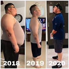After about eight weeks on the gastric bypass diet, you can gradually return to eating firmer foods. Testimonials Reviews Benjamin Clapp Md Facs Fasmbs El Paso Surgeon