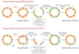 Ijms Free Full Text Kidney Cells Regeneration Dedifferentiation Of Tubular Epithelium Resident Stem Cells And Possible Niches For Renal Progenitors Html