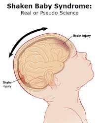 Monday Morning Thoughts The Troubling History Of Shaken Baby Syndrome Davis Vanguard