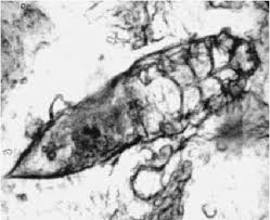 Image result for Demodex brevis