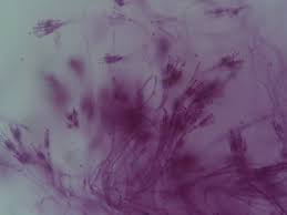 Penicillins may be used to treat a wide range of infections caused by susceptible bacteria. Penicillium Wikipedia