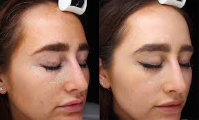 Shop for environ® skin care, the globally recognised range based on science and results. Influencer Highlights Environ November 2016 Iiaa Ltd The Uk And Ireland Distributor Of Environ Skincare Jane Iredale Makeup And Advanced Nutrition Programme