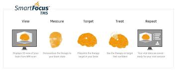 Get the latest nexstim stock price and detailed information including news, historical charts and realtime prices. Nexstim Navigated Brain Therapy Nbt System Ampere Medical
